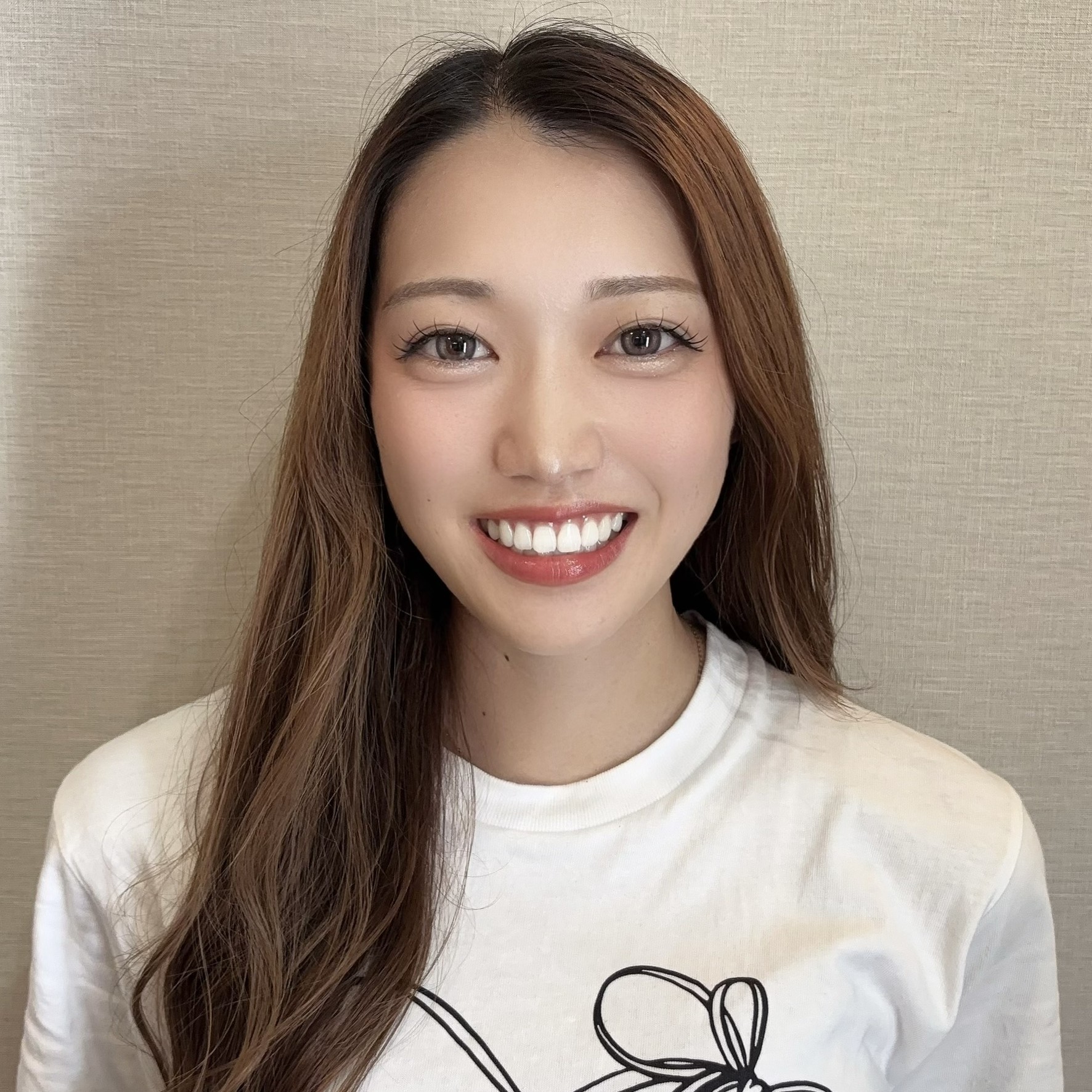 あこ